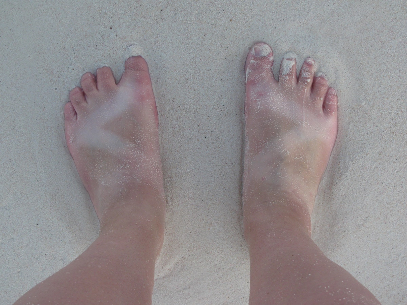 Tan lines from Melissa's sandals